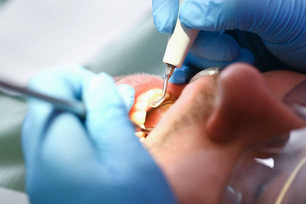 Best Emergency Dental Services for Seniors in Mount Ivy, NY