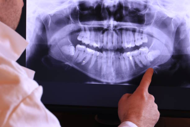 Best Holiday Emergency Dentist in Mount Ivy, NY