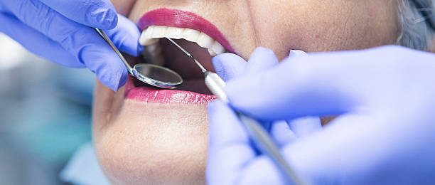Best Emergency Root Canal Treatment in Mount Ivy, NY
